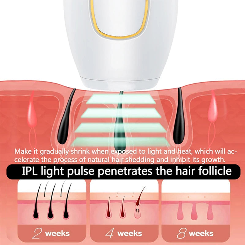 Épilateur Laser IPL Professionnel Homme Femme - Usage Domestique