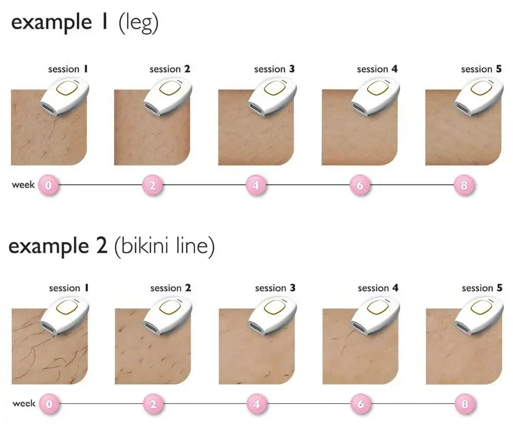 Épilateur électrique indolore pour femme, épilation au laser pulsé, corps, bikini, ati elles, flash, IPL 500000, équipement domestique, nouveau